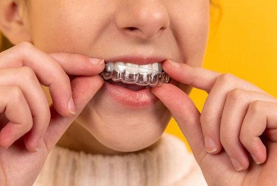 Slider image (4) DG Dental - Dr. Diana Gastelum
